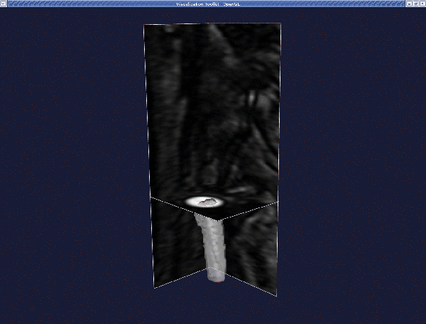 deformable_model1.gif